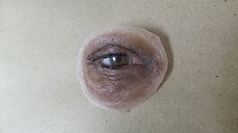 An eye prosthetic device custom-made at the Buffalo Center for Anaplastology